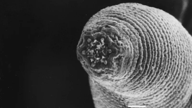 Deep Underground, a Tiny Worm Defies All Expectations and Expands the Frontiers of Biology