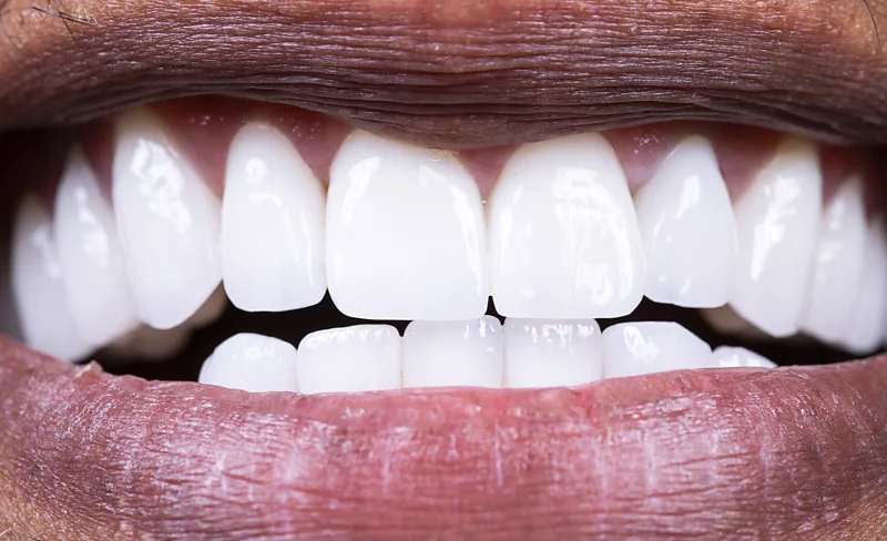 A diet for healthy teeth: what to eat to protect your mouth's good bacteria
